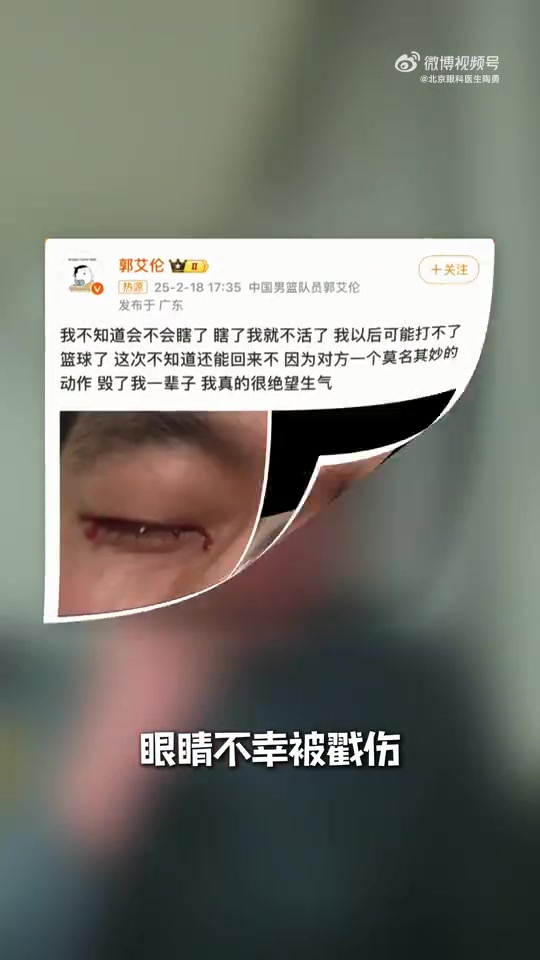png电子眼科专家谈郭艾伦：结膜受伤经处理大概率恢复得不错 不要太忧心