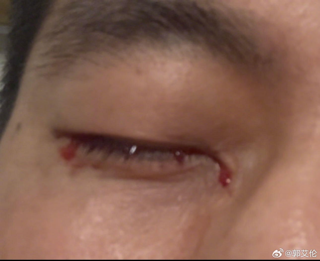 电子png游戏红星新闻：郭艾伦受伤是在训练最后一个回合 在场的球员都很自责